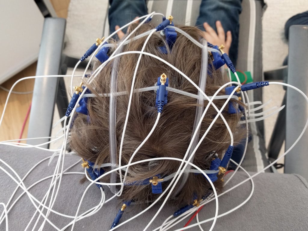 EEG 1